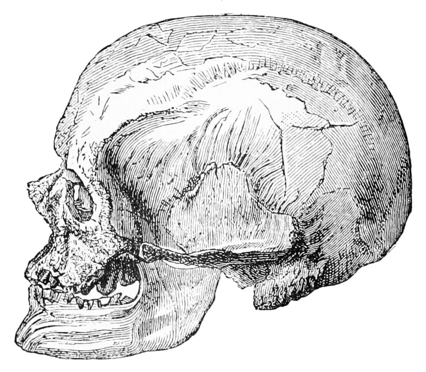 Crâne d'un homme de Cro-Magnon découvert à l'abri des Eyzies en Dordogne