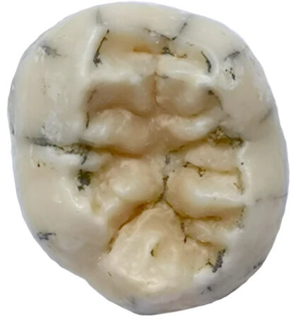 Mandibule TNH2-1 de Xiahe, specimen denisovien du plateau tibetain