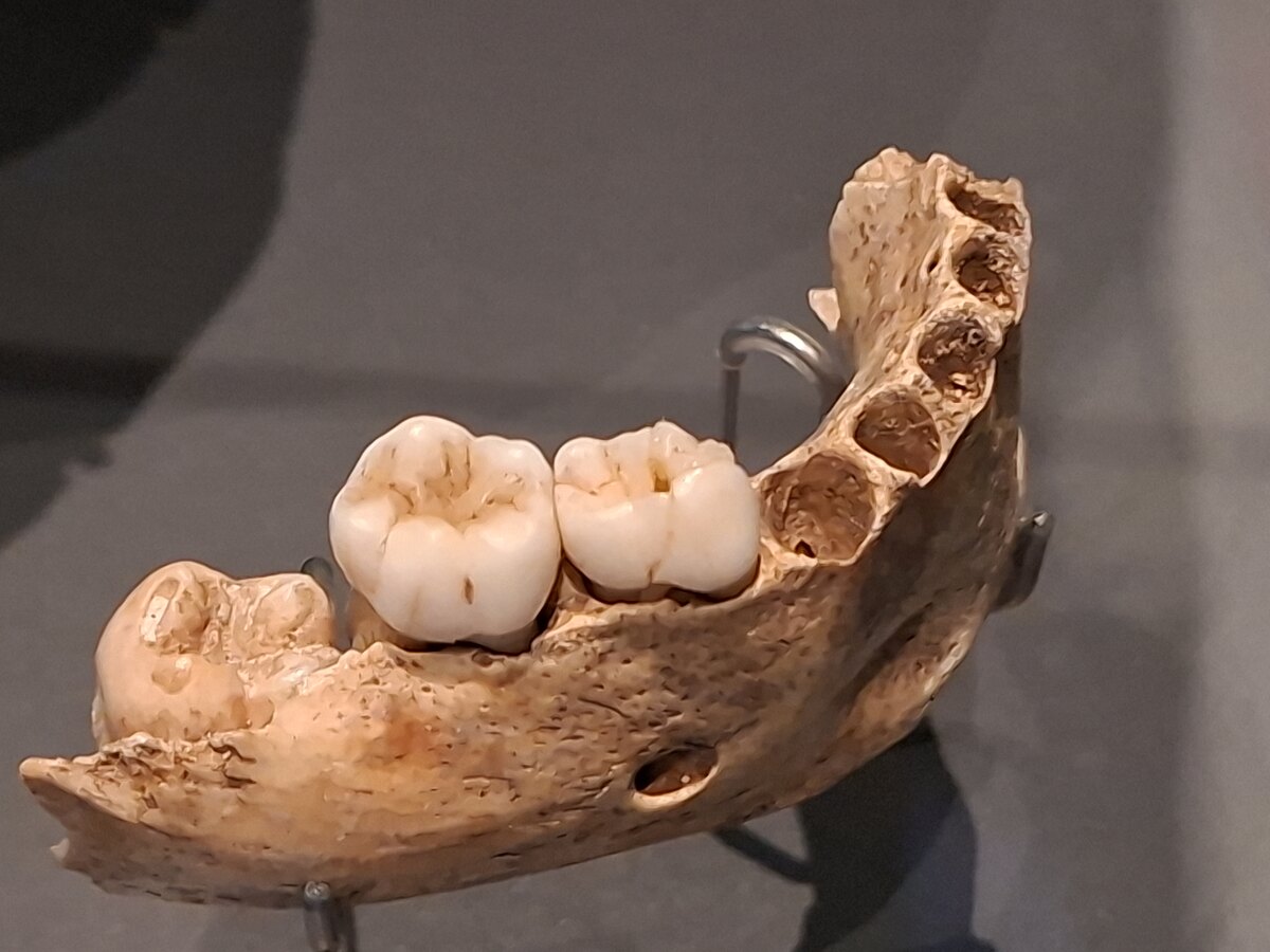 Neanderthal mandible showing teeth