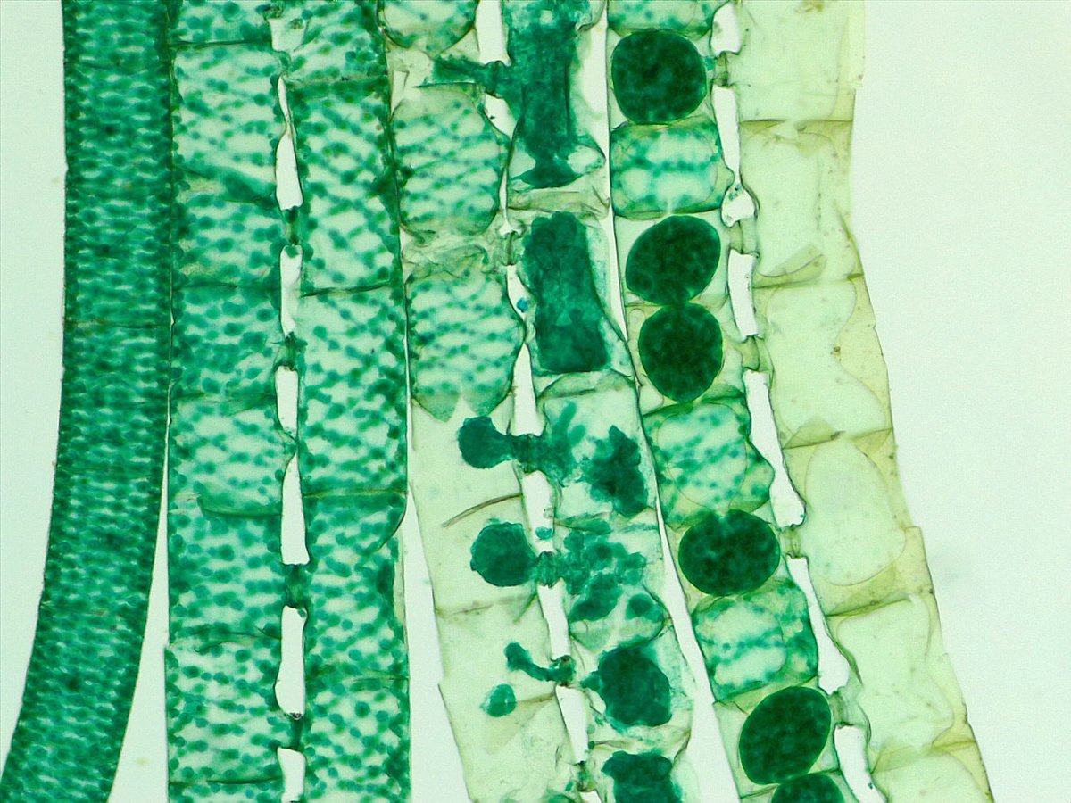 Conjugaison chez Spirogyra, algue filamenteuse - Wikimedia Commons CC BY-SA 4.0
