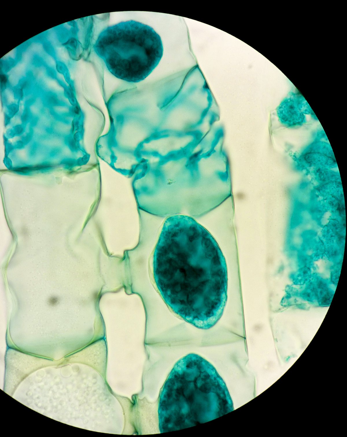 Conjugaison chez Spirogyra, formation du tube de conjugaison - Wikimedia Commons CC BY-SA 4.0